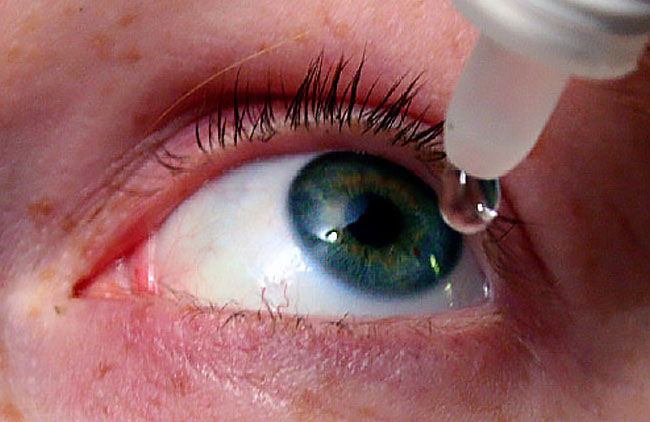 leczenie suchego oka